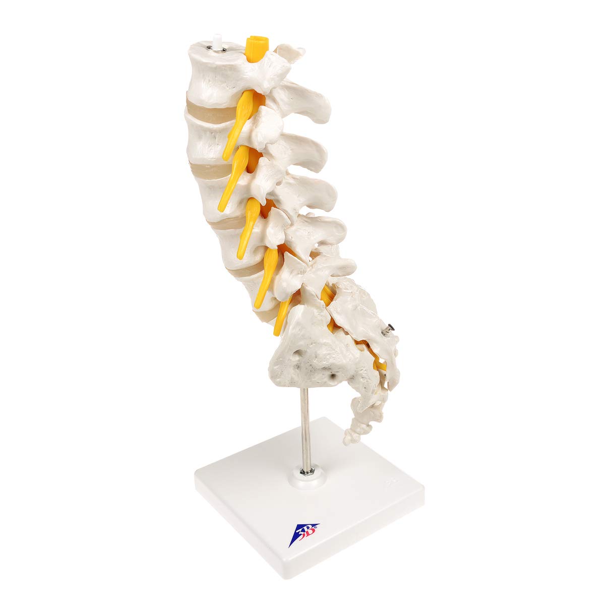 3B Scientific A76/5 Colonna Vertebrale Lombare con Ernia del Disco Dorsolaterale + software gratuito di anatomia - 3B Smart Anatomy