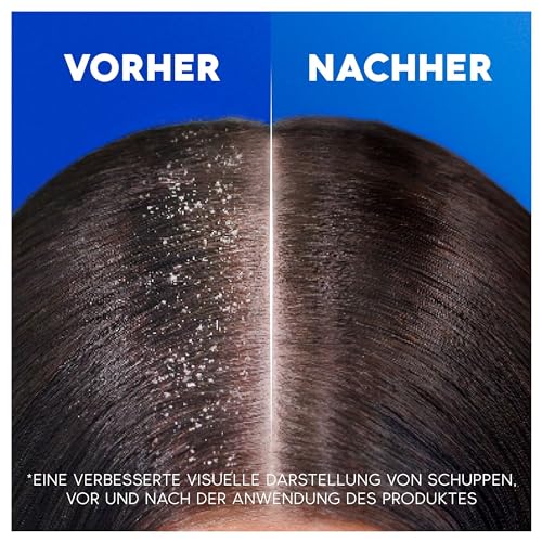 Foto von Head & Shoulders Classic Clean Anti-Schuppen-Shampoo 300ml zur Täglichen Anwendung, bis zu 100 Prozent Schuppenschutz, klinisch getestet, für jeden Haar- und Kopfhauttyp, sauberes Frischegefühl