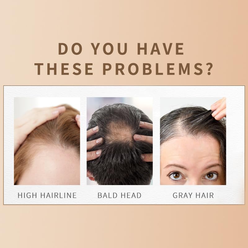 Dark Brown Hair Building Fibers for Thinning Hair Instant Thickener and Concealer Windproof & Water Resistant Volumizing Powder for Men and Women (Pack of 1)