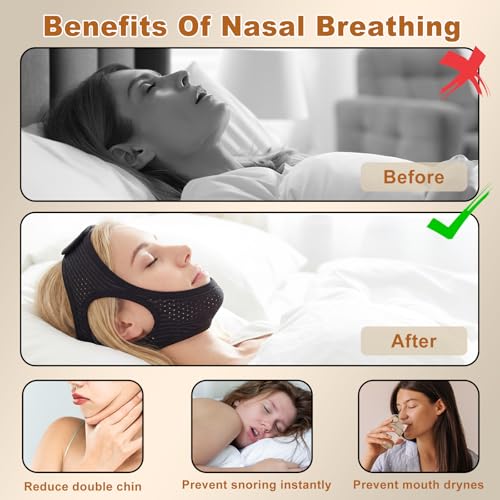 image for Aikaplus Sleep Apnea Devices - Chin Strap for Sleeping, Airflow Jaw St