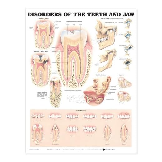 Disorders of the Teeth and Jaw Anatomical Chart
