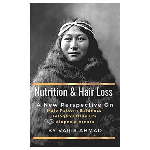 NUTRITION AND HAIR LOSS: A NEW PERSPECTIVE ON Male Pattern Baldness Telogen Effluvium Alopecia Areata