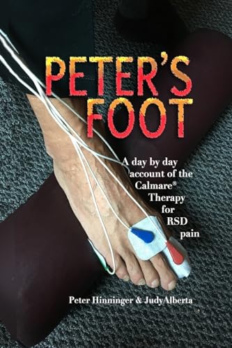 PETER’S FOOT: Calmare Treatment for RSD Pain Relief