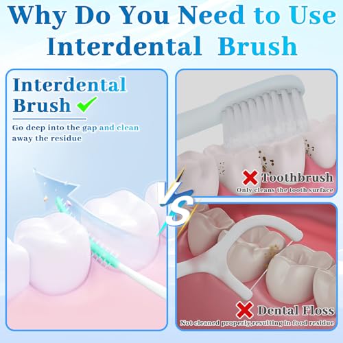 WOHSEROM 200 Pcs Dual-Use Interdental Brushes - Image 4