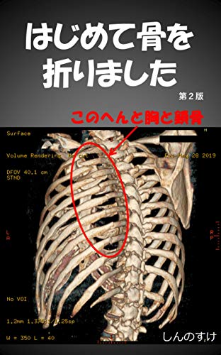 I Broke My Bones For The First Time I Broke My Bones For The First Time Japanese Edition Ebook Shinnosuke Amazon Co Uk Kindle Store