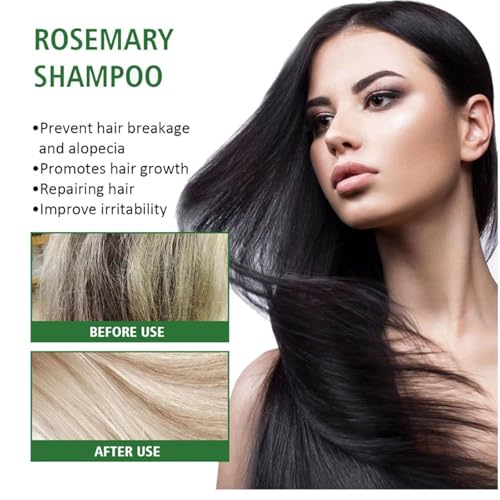 Image of 2026 New Eloria Beauty Shampoo,Rosemary & Biotin Hair Growth Shampoo Anti Hair Loss,Soft and Shine,Hair Loss and Thinning,Growth for Women and Men (1PCS)