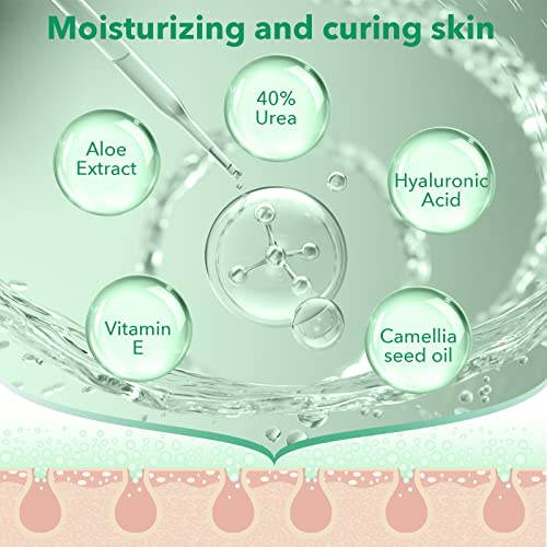 Urea Cream 40 Percent For Feet - 2% Salicylic Acid, Vitamin E, Aloe Vera, Hyaluronic Acid, 7 Oz, Deeply Moisturize Skin Cream For Dry Cracked Feet, Hands, Heels, Elbows, Nails, Knees, Intensive Moisturizes & Softens Skin, Exfoliates Dead Skin #TOP26