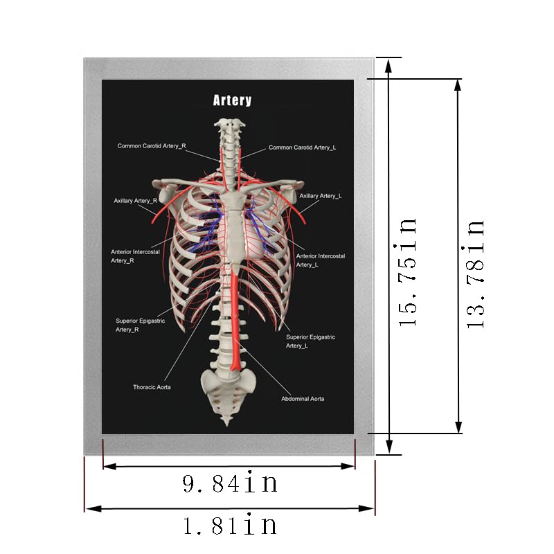 Image of Taanfu Body Educational Learning Anatomy Posters ，Arterial skeleton Art Arterial Villi Anatomy Art Poster Digestive System Organs Illustration Small Intestine Physiology Anatomy Wall Art Villi