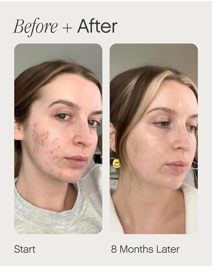 Image of Faded Brightening and Clearing Serum | Reduces Discoloration Post-Blemish Marks Scars Spots Contains Niacinamide Dermatologist-tested Vegan Cruelty-Free 50ml 1.7 Fl Oz (Style-4)