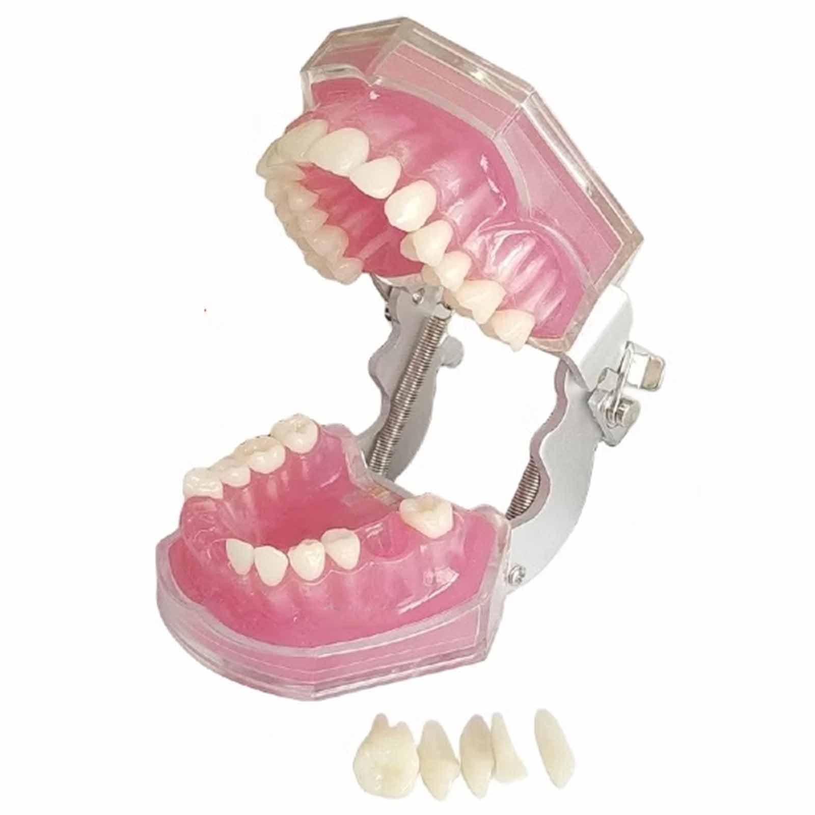 Model Demonstracyjny Zębów Dentystycznych, Model Z Wyjmowanymi Miękkimi Dziąsłami Do Nauki, Model Dydaktyczny Dla Dorosłych (Różowy, 8 Cm),Pink-8cm