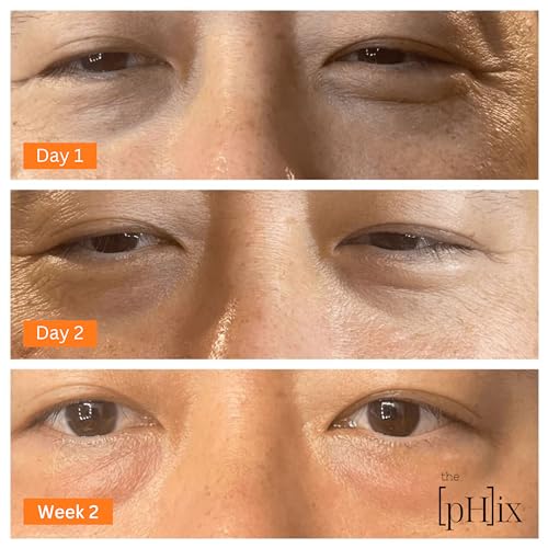 The Phix Caffeine Eye Cream With Hyaluronic Acid thumb #5