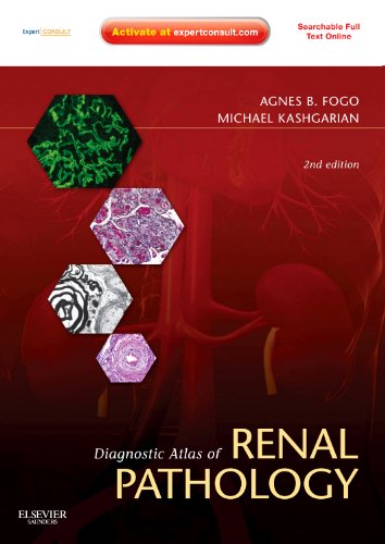 Diagnostic Atlas of Renal Pathology: Expert Consult - Online and Print