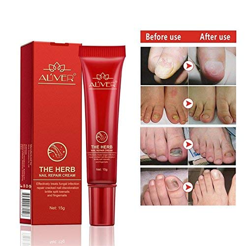 Aliver Herb Premium Fungal Nail Treatment Powerful Anti Fungal Nail
