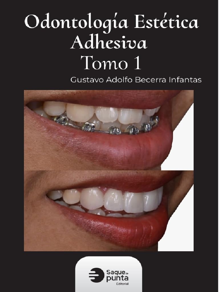 Odontología estética adhesiva: Tomo 1
