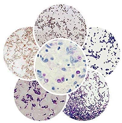 25-Set Prepared Microscope Microbiology Slides Sample Gram Stain Human Medicine Veterinary for Medical School Education