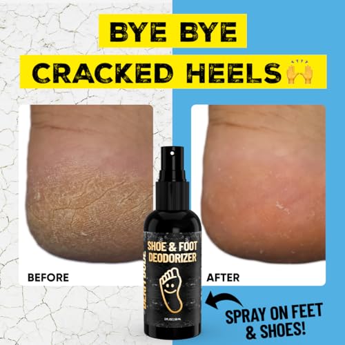 Derm Dude Foot & Shoe Deodorizer Spray | Formulated With All-Natural DeoPlex for Odor Control | Witch Hazel, Aloe Vera, Tea Tree Oil & Peppermint to Freshen Feet & Shoes | Travel Size, Mint Scent 2 oz - Thumbnail 6