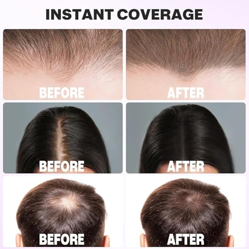 ALVIKO Cover-Up Hair Powder Black 4g - Image 5
