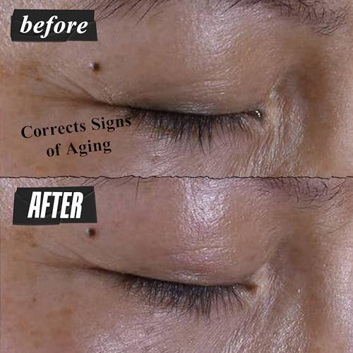 Kiehl'S 3605972683250 Super Multi-Corrective Eye Cream thumb #2