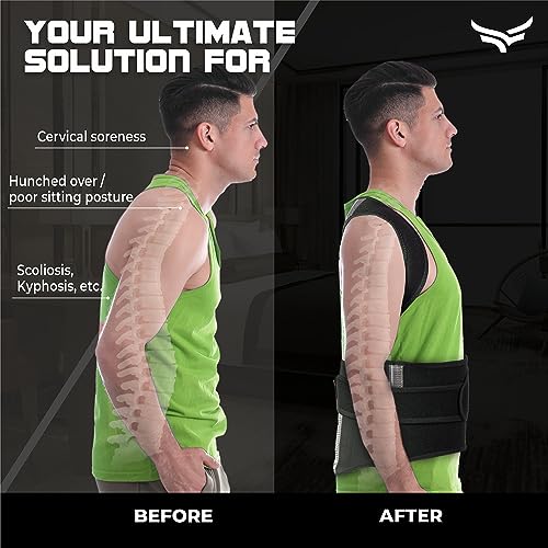 Image of XTRIM Posture Corrector for Men & Women, Adjustable Back Support Belt for Back Pain Relief, Spine Posture Corrector with Soft Shoulder Pads, Back Straightener Belt (Medium)