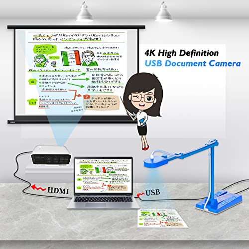 Treaslin Usb Document Camera 10Mp For Teachers, Remote Learning, Classroom Presentations, Art Classes Online Teaching With Multi Angle Rotation Adjustment Led Light #TOP4