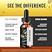 TruVarin Drops - Official Advanced Formula Supplement - Truvarin to Support Healthy and Beautiful Hair, Natural Liquid Formula for Hair Growth and Healthy Scalp, Premium Tru Varin Reviews (1 Pack)