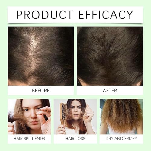 Image of 2026 New Eloria Beauty Shampoo,Rosemary & Biotin Hair Growth Shampoo Anti Hair Loss,Soft and Shine,Hair Loss and Thinning,Growth for Women and Men (1PCS)