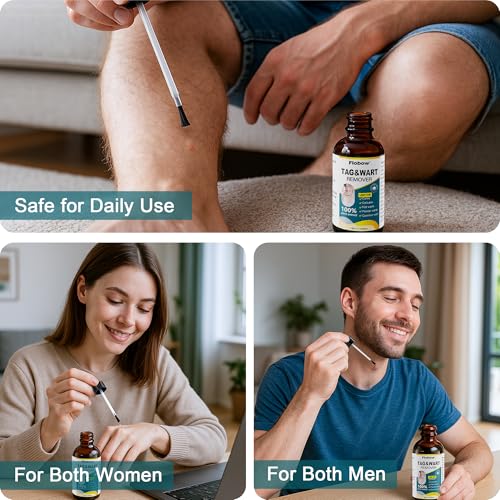 Image of TAG WART Remover, Freeze Off Liquid with 17% Salicylic Acid - Fast-Acting Freeze Off Treatment for Common & Plantar Warts,Flat Wart, Corns - for Feet, Hands & Body (1oz)