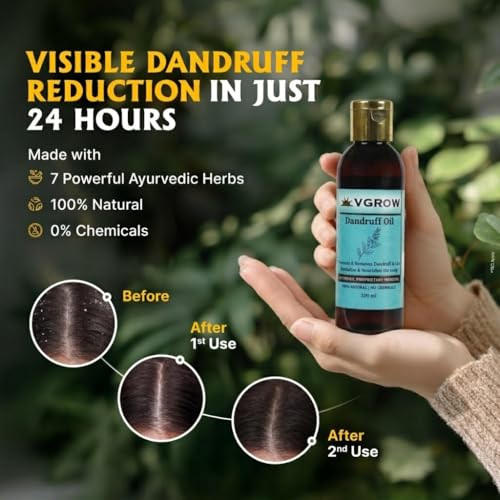 Image of VGROW Natural Dandruff Oil, Ayurvedic Hair Treatment, 100 ml