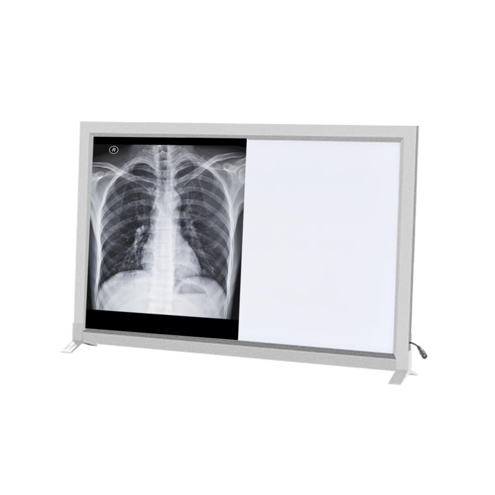 Amazon.com: GMBAYUE LED X-Ray View Box, Portable X-Ray LED Film
