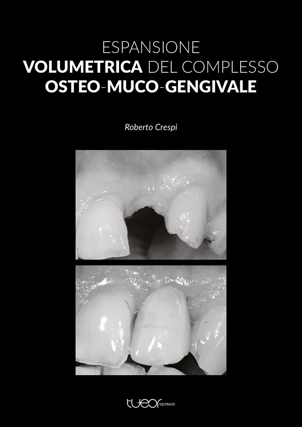 Espansione Volumetrica Del Complesso Osteo-Muco-Gengivale - 4
