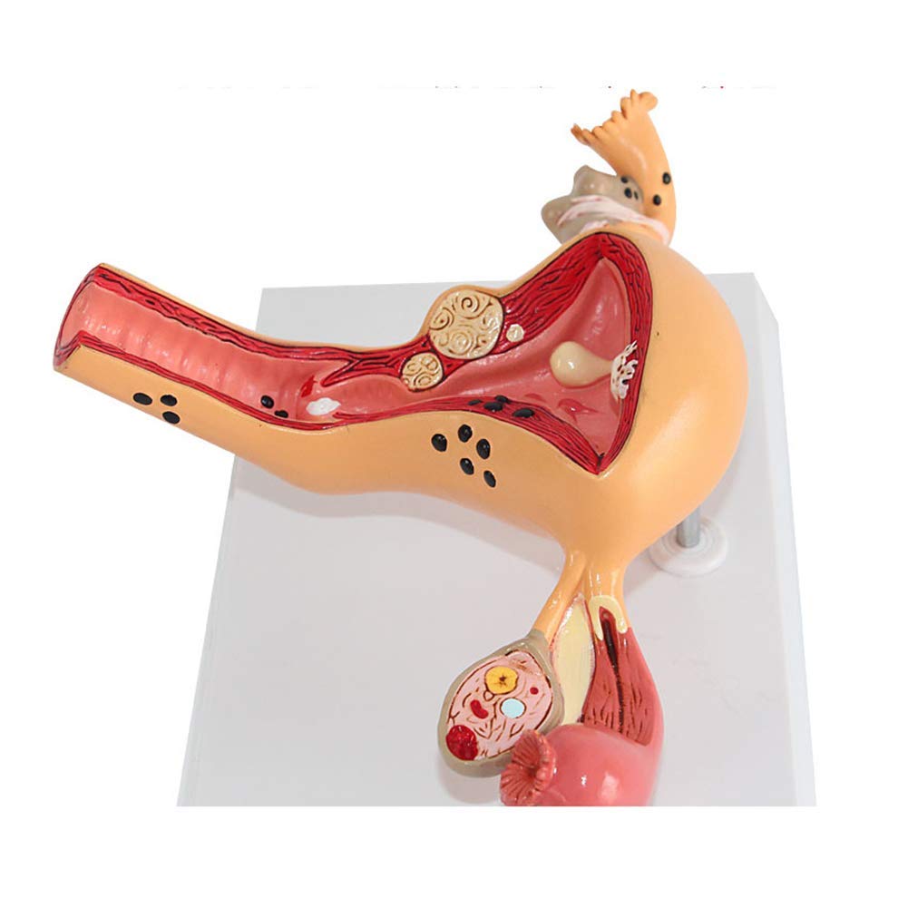 Sjdopulse Women's Human Uterine Disease Model, Ovarian Model, Uterine Model-Doctor-Patient Communication Medical Education