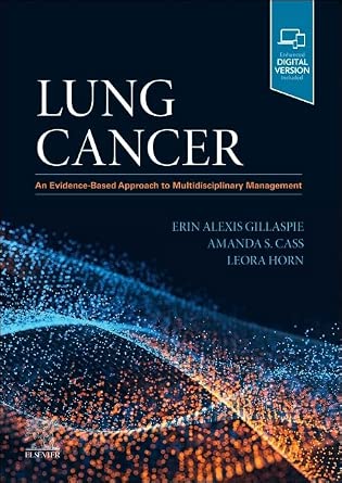 Lung Cancer: An Evidence-Based Approach to Multidisciplinary Management book cover