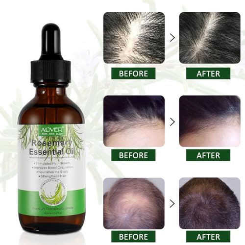 Rosemary Oil for Hair Growth Rosemary Oil for Hair Loss Damaged Hair Stimulates Hair Growth, Nurshes Dry Scalp - Image 3