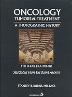 Oncology: Tumors & Treatment, a Photographic History The Anesthesia Era 1845-1875. Selections From the Burns Archive 0974868809 Book Cover