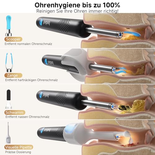 BEBIRD R1 Ultra Ohrenschmalz Entferner Kamera, Ohrenreiniger mit Otoskop für Zuhause, Komplett-Set mit Sichtbarer Dropper & Pinzette, Für Ohr & Nase & Rachen Untersuchung der Familie-Schwarze