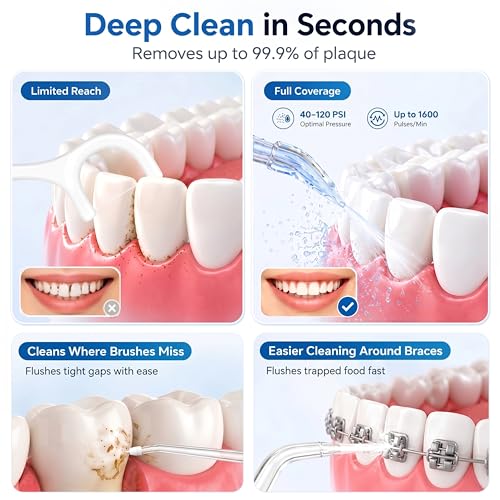 Image of KAMEX Cordless Water Flosser for Teeth Cleaning: Portable Oral Irrigator with 300ML Tank, 5 Jet Tips, 4 Modes, 40-120 PSI, IPX7 Waterproof, Rechargeable Dental Water Pick for Braces & Sensitive Gums