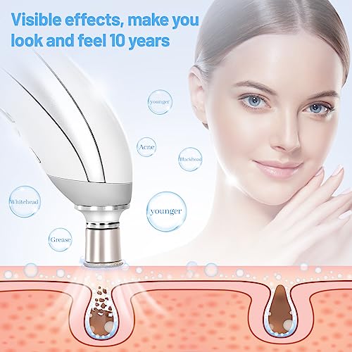 mcwdiot Diamond Microdermabrasion Kit