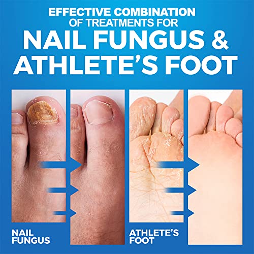 Fungal nail treatment and athlete's foot set - Image 4