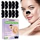 Clear-up Strips Segminismart Nosestripes gegen Mitesser
