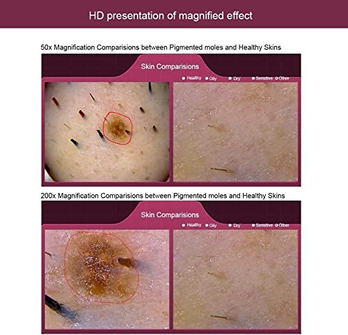 Hdgrncc Usb Skin Hair Scalp Detector, 5-200X Digital Microscope Skin Analyser 200Mp Camera Beauty-Care Detector For Hair Follicle Testing And Skin Analysis #TOP1