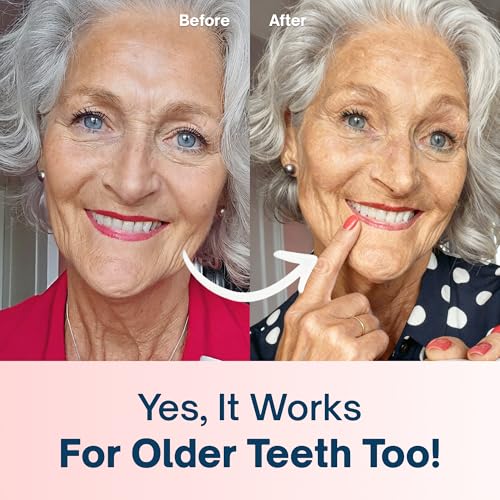 Image of MySweetSmile Teeth Whitening Powder - 6 Month Supply - Removes Years of Coffee, Tea, Smoking & Ageing Stains - Dentist-Approved & Enamel-Safe - IndyBest Award-Winning Whitener (Strawberry)