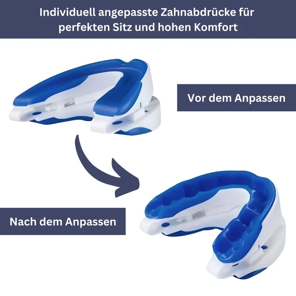 Schnarchschiene - Protrusionsschiene - GesundPur Anti Schnarch Nacht Knirscherschiene Verstellbare Effektiv Schnarchlösungen (3x)