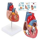 ASINTOD Human Heart Model, 2-Part Life Size Cardiac Anatomical Model, 48 Accurate Numbered...