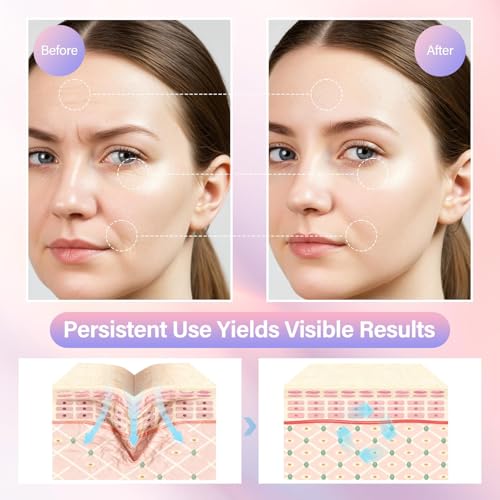 Image of Neck and Face Care Device for Home Daily Use, Skin Care Tool, Wrink-le Improve, Firm, Tightening and Smooth Snow White
