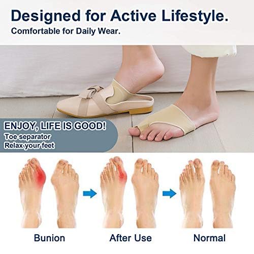 Coussinet Correcteur D'orteils En Silicone Pour Hallux Valgus - Soulage La Douleur Et Redresse - Neuf