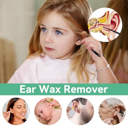 Ohrenreiniger Edelstahl Set, 10 Stück Ohrenschmalz Entferner, Ear Cleaning Ohr Schmalz Reiniger Werkzeug, Sichere Spirale Ear Cleaner Ohren Reinigung Werkzeug für Kinder Erwachsene