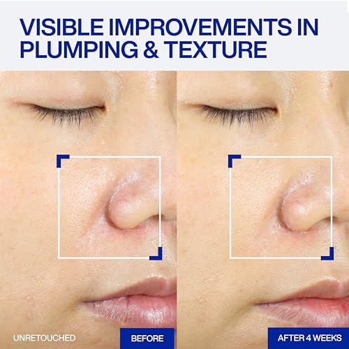 Image of IOPE XMD Stem III Clinical Recovery Serum - Professional PDRN Treatment-Level Results - Visibly Firms, Plumps Volume, and Refines Pores - With Hyaluronic Acid - 1.01 fl. oz.