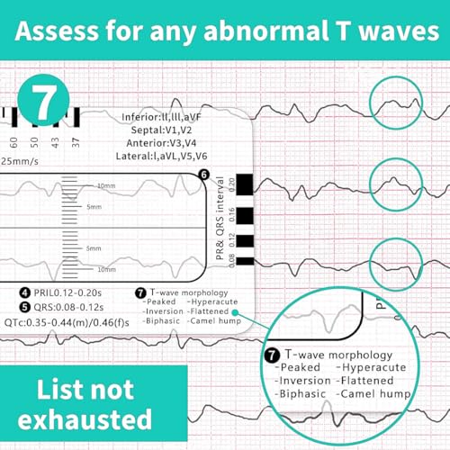 HQRKOTM 2 PCS ECG 7-Stufen-Linealkarte für ECG/EKG Interpretation, Tragbare Tasche, Kunststoff, 85.6 mm x 53.98 mm, Medizinisches Instrument, Einfacher Kunststoffaufbau,ecg 7 step ruler