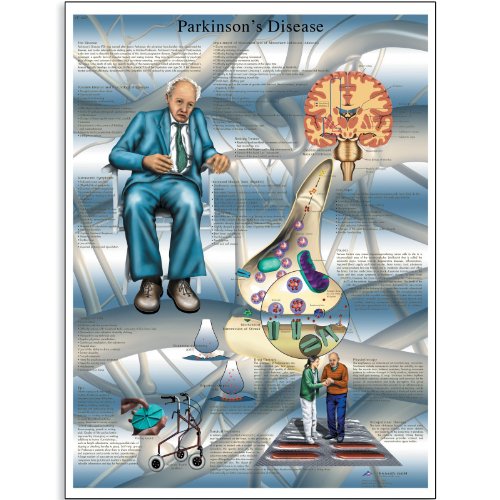 Image of 3B Scientific VR1629L Glossy UV Resistant Laminated Paper Parkinson's Disease Anatomical Chart, Poster Size 20 inch Width x 26 inch Height