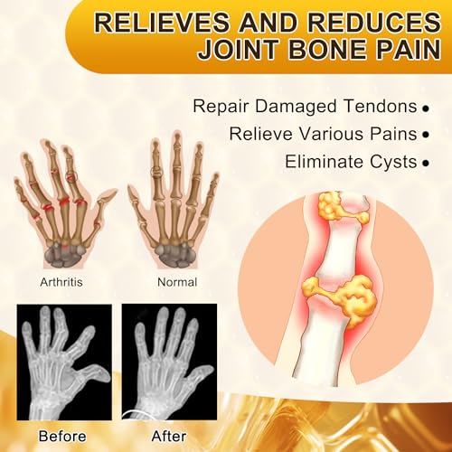 BSOON Bienengift Creme 2 Stück Honey Bee Venom Bone Healing Cream, Australian Bienengift Knochenheilungscreme, Gelenk Behandlungscreme Bienengift Pflege Reparatur Creme – Bild 3